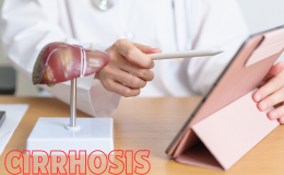 Understanding Cirrhosis: Causes, Symptoms, and Treatment