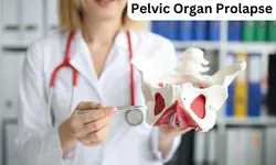 Understanding Pelvic Organ Prolapse: Causes, Symptoms, and Treatment Options