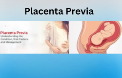 Understanding Placenta Previa: What Every Expectant Mother Should Know