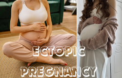  Understanding Ectopic Pregnancy Symptoms Risks and Treatment