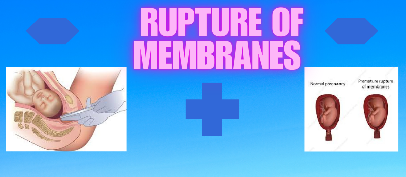  Understanding the Rupture of Membranes: What You Need to Know