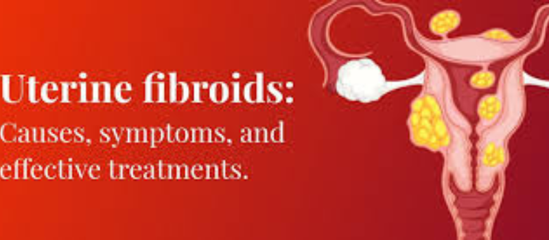  Understanding Uterine Fibroids: Symptoms, Causes, and Treatment Options  Introduction: