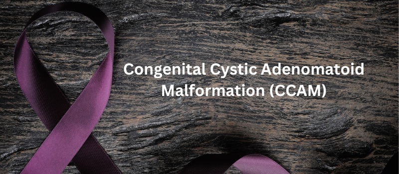 Understanding Congenital Cystic Adenomatoid Malformation (CCAM): A ...